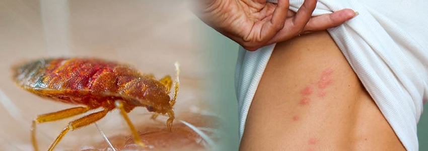 pest control services in Addis Ababa Ethiopia